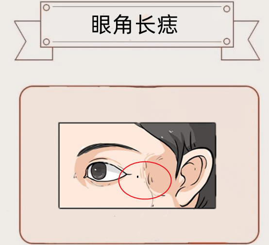 富贵痣,身体5颗金钱痣,财运亨通,仕途顺利,百里挑一的好命!