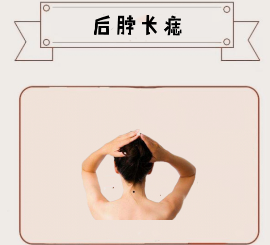 权贵痣万两难买4颗吉痣佛祖庇护个个升官发财