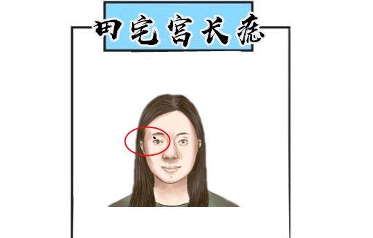 万金难抵5颗痣命里藏金个个财大气粗百里挑一