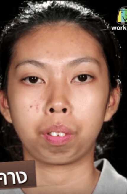 丑女节目现场被狠狠嫌弃,她含泪整容,一个月后嫌弃她的人傻眼