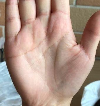 此种手相的人 注定是操劳命 难发大财 生命线 感情线 链状 新浪新闻