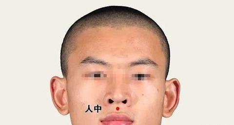 夏天中暑急救法:按人中刺十宣|晕厥|中暑|急救_新浪新闻