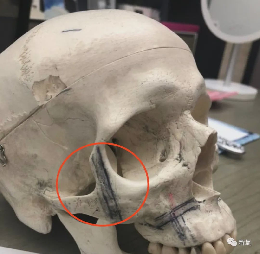 眼眶|鞠婧祎|发际线_新浪新闻