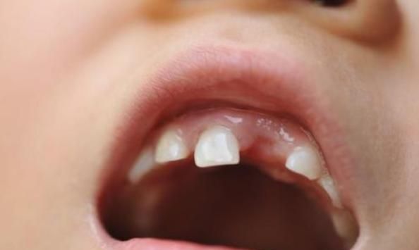 为啥老人会把孩子换掉的乳牙"扔房顶"?并不是迷信,原因很有爱
