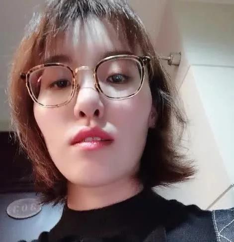 有种"逆袭"叫傅园慧,整牙后美到不敢认,原来baby没说谎!