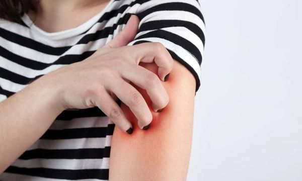 身体奇痒无比怎么办?不瞒你说:4个方法能坚持,有效止痒