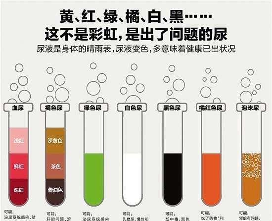 乳白色,酱油色,黑色,洗肉色等,总之若出现和正常尿液颜色反差巨大的