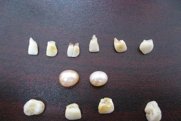 为啥老人会把孩子换掉的乳牙"扔房顶"?并不是迷信,原因很有爱