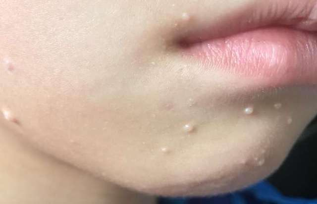 黄磊带女儿去医院治疗瘊子,妹妹痛到哭喊:再也不喜欢动物了