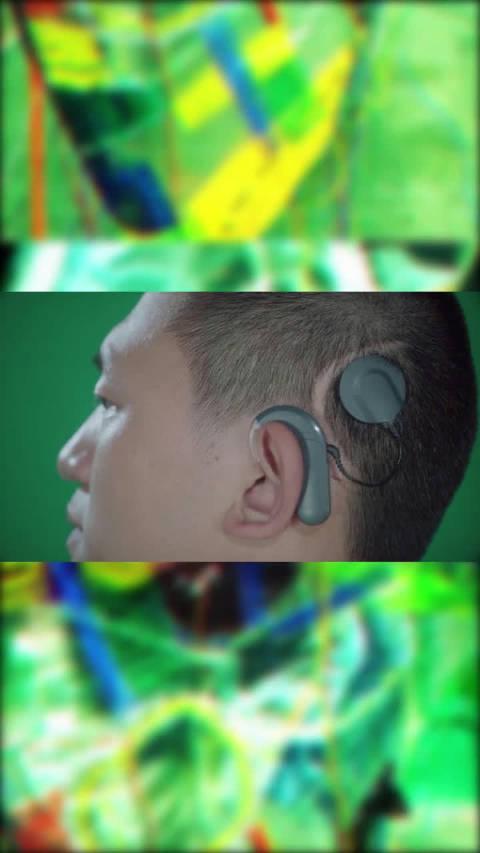 装上人工耳蜗后听到的真正的声音