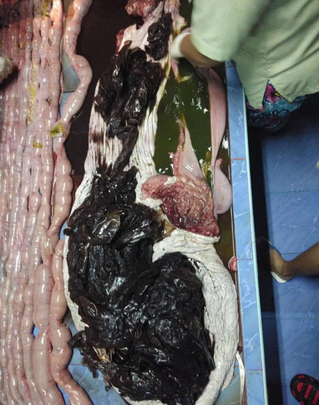 一头鲸鱼不幸死亡,解剖之后在胃中发现80多个塑料袋