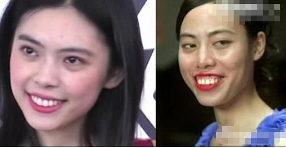 功夫|龅牙|陈凯师_新浪新闻