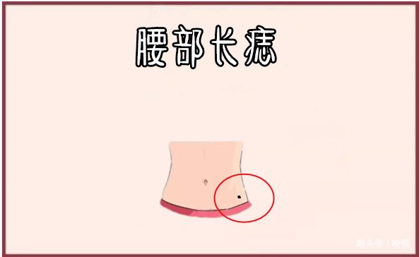 腰部长痣在相学当中,若是一个人的腰部的位置长有吉痣,大多数会有"