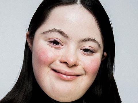 以行动证明美丽无界限gucci邀请唐氏综合症少女当模特儿