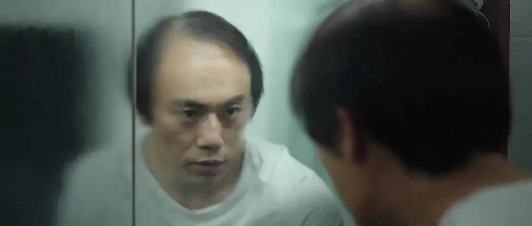张东升的头发是怎么没的?|雄激素|脱发|隐秘的角落|秃发|毛囊_新浪新闻