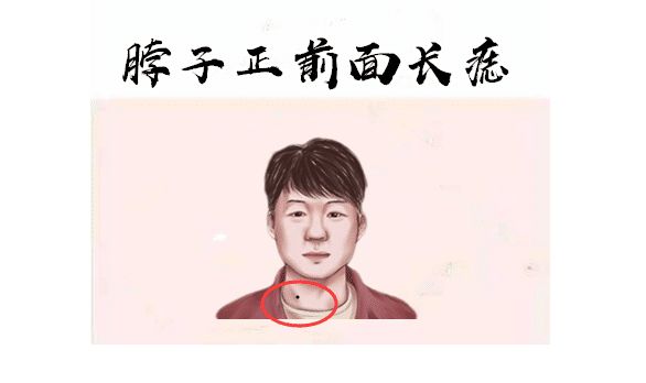 若是在胸部的位置长有恶痣,被称之为"狼心狗肺痣",一般的情况下,在