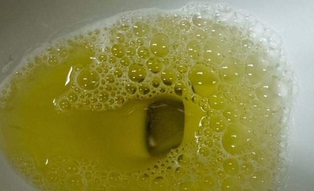 尿酸太高,小便会有3个特别的"变化",若全占,或是该养肾了