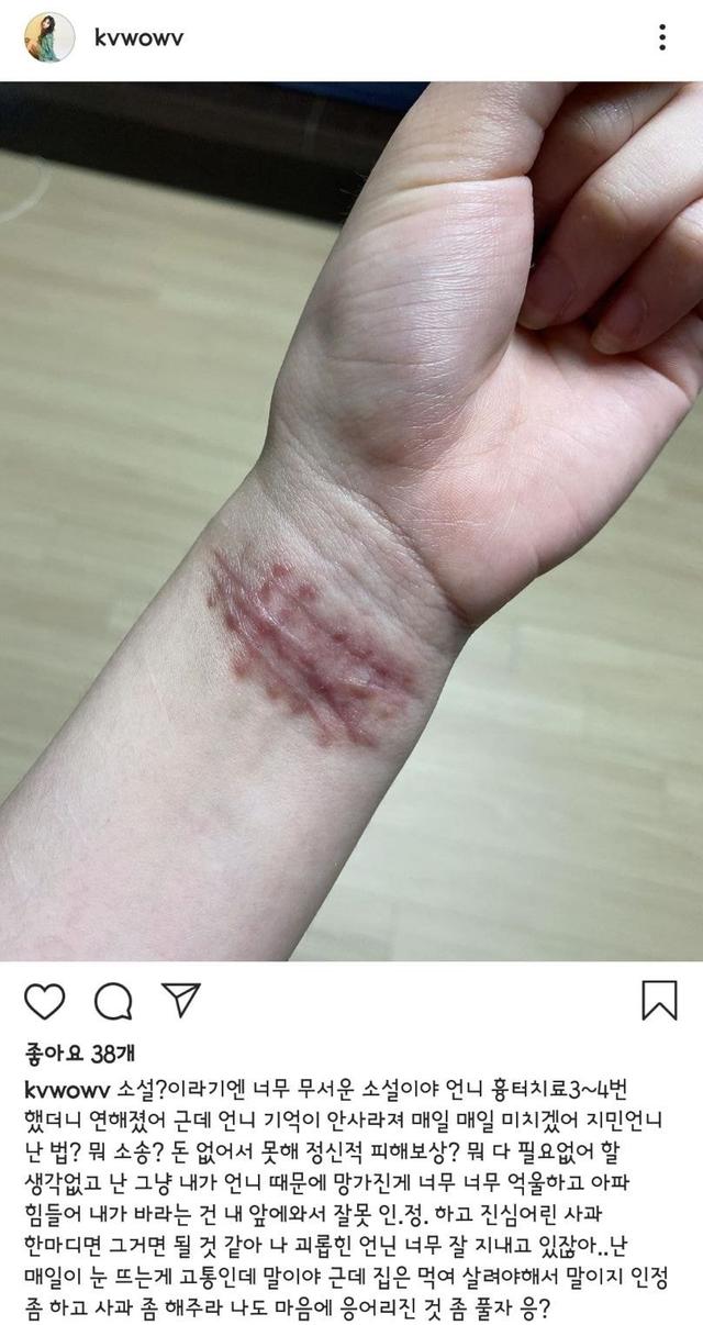 在社交网站上再次晒出手腕照片,疑似曾割腕自杀,并发文要求申智珉承认