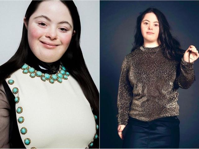 gucci也正确了唐氏患者做模特推彩妆系列首日获80万点赞