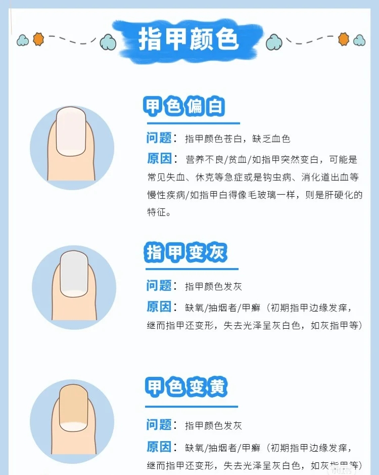 健康指甲具有哪些特征?
