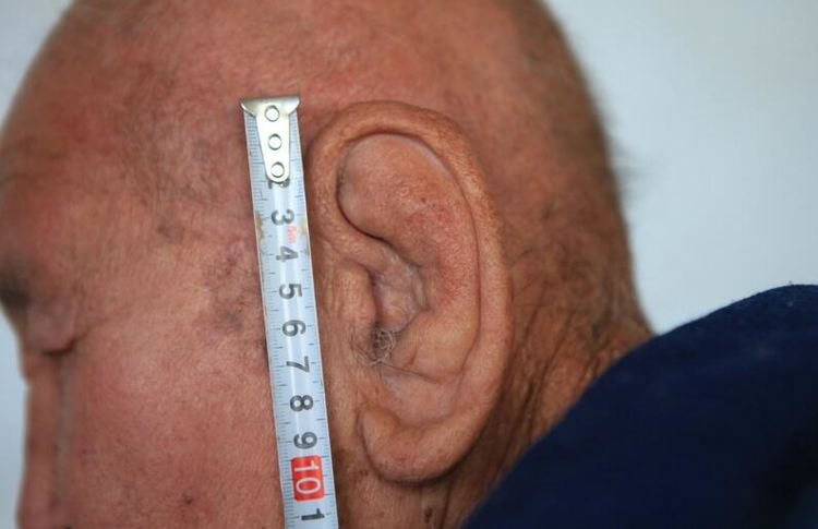 老人的耳朵比正常人要大很多,厚很多,而且仔细观察后你会发现,老人的