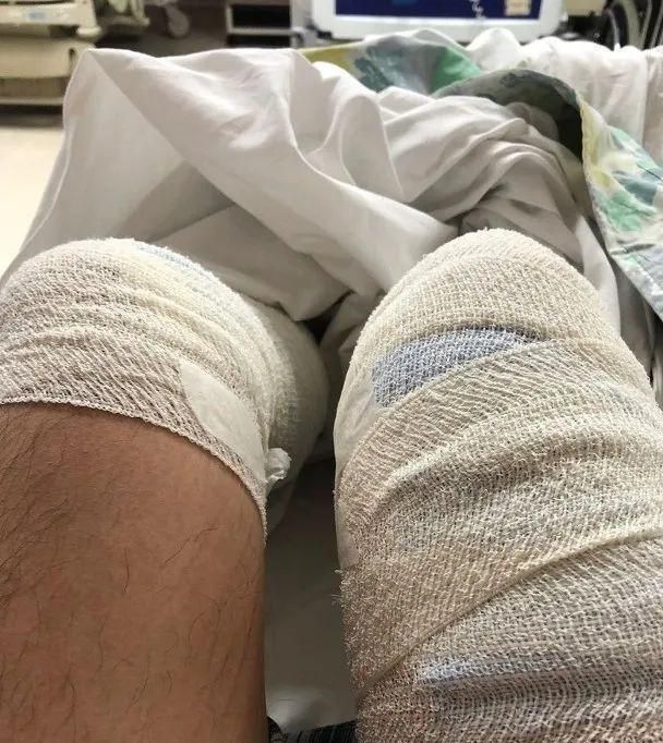 坠海受伤入院香港知名男星不幸撞礁石致全身多处划伤乐极生悲