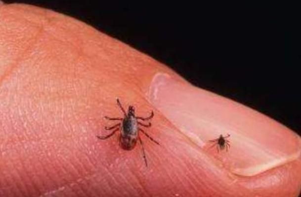 接下来就和我看看吧,这些曾经出现在人类生活中的虱子,大体可以分为