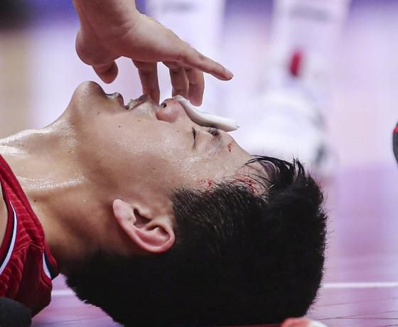 报平安姜宇星缝十针后已返回酒店伤势无大碍吉林跌第十需要他