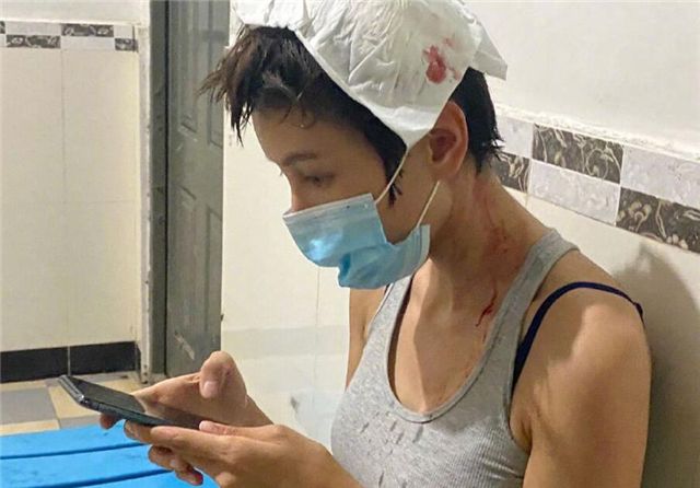 张蓝心拍戏头部受伤,伤口3厘米,包扎后回到剧组被赞敬业