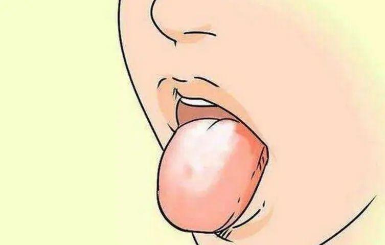 2,舌头发红      健康的舌头,是淡粉色的.