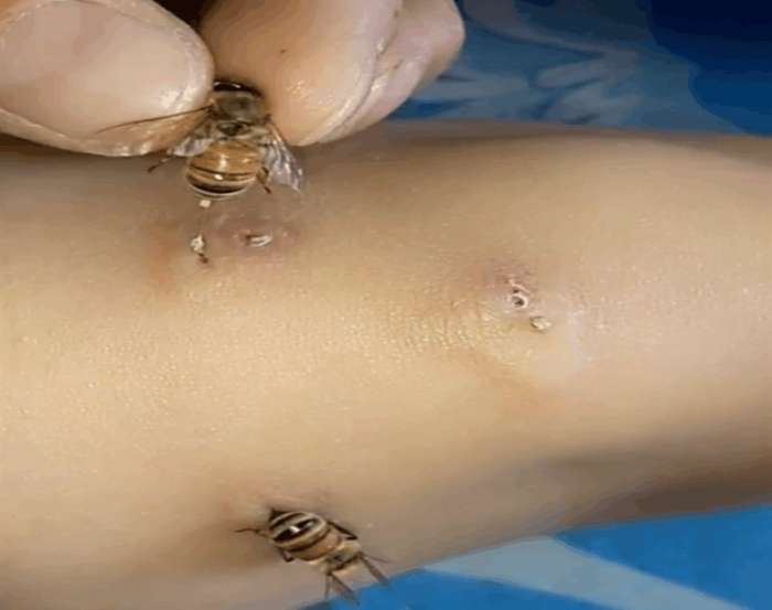 农村女子作死拿蜜蜂蜇自己, 旁边人骂她傻,得知原因深信不疑