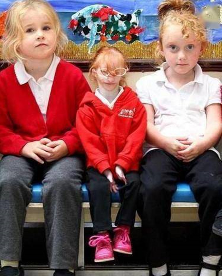 14年过去,出生时不足1斤的"拇指姑娘"现状如何?网友:大反转