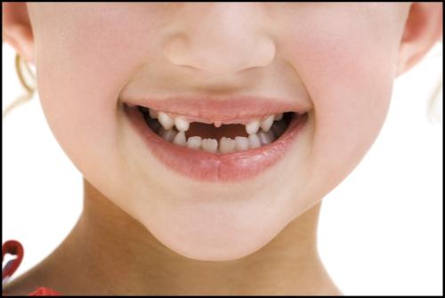 宝宝乳牙越长越稀,妈妈担忧换牙问题,医生:可能是个高颜值