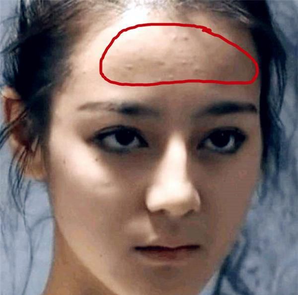 鸡皮疙瘩明星(鸡皮疙瘩特型演员) 鸡皮疙瘩明星(鸡皮疙瘩特型演员)