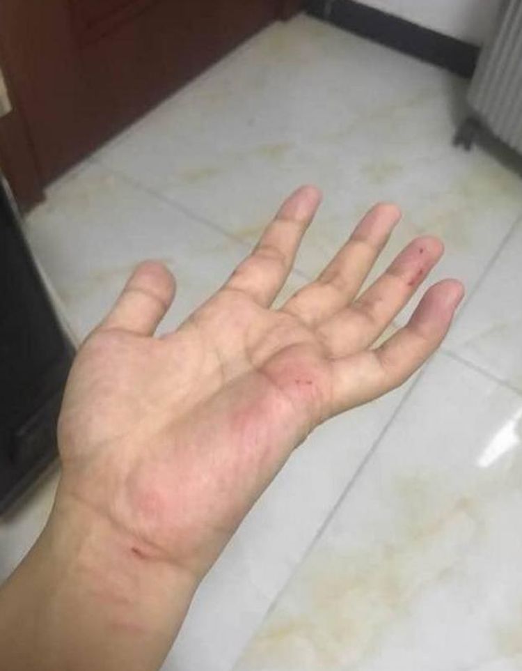 小泰迪咬人屡教不改,宠主气得"发大招",网友看了瞬间笑尿