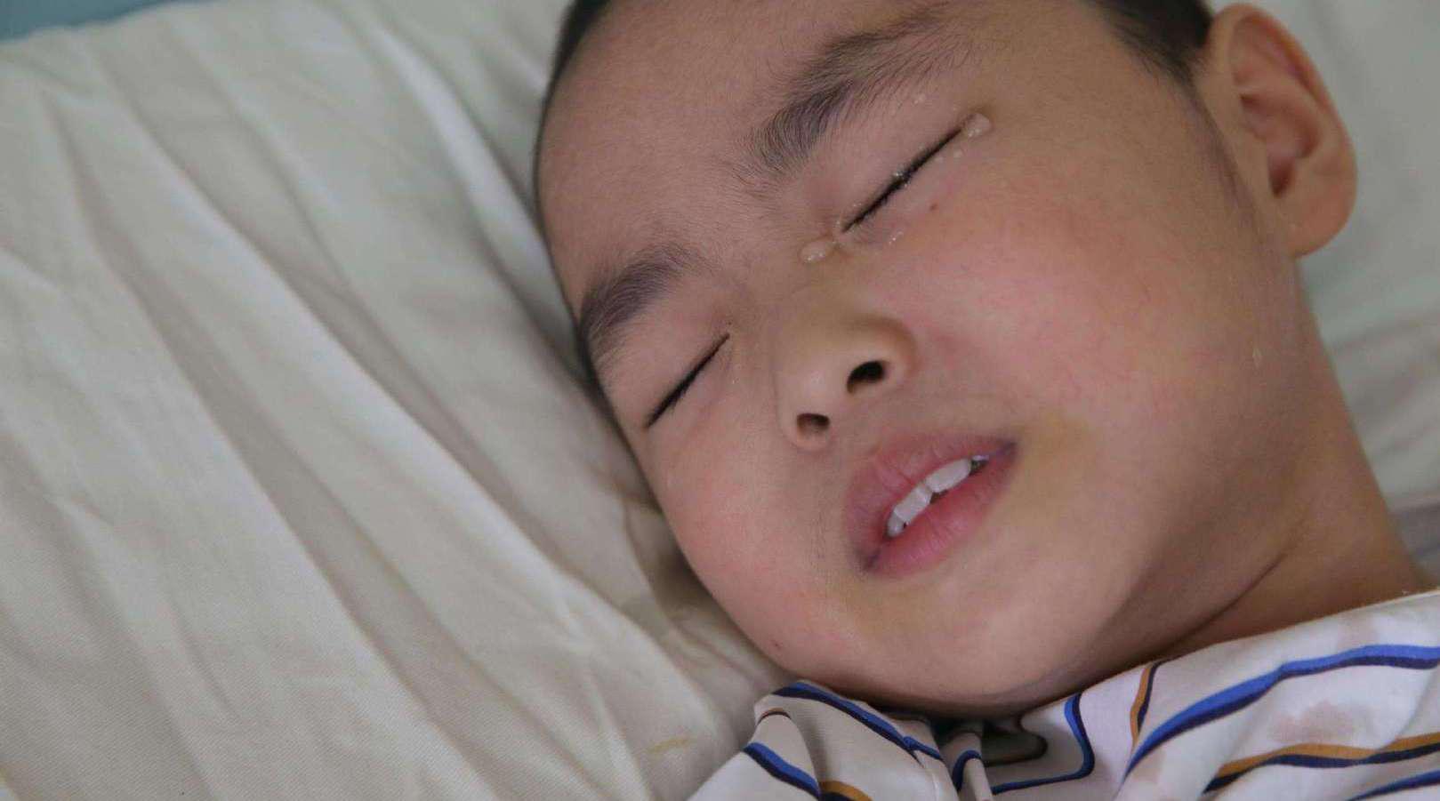 孩子有这四种表现,可能是肚子里有"虫"了,家长别忽略