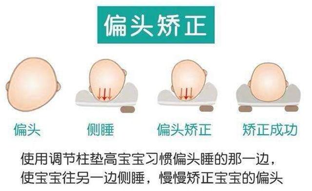 宝宝偏头不仅影响美观,对颅骨发育和五官功能也有害,及时纠正