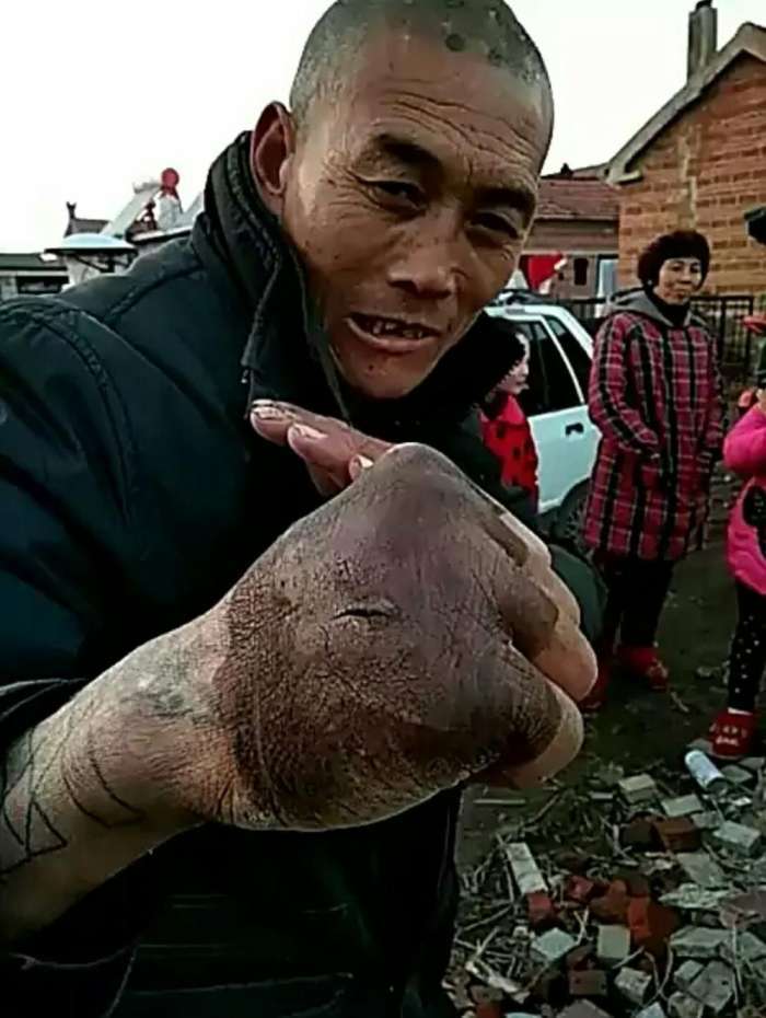 60岁大爷苦练"铁砂掌", 神功已练成, 却苦了这双手