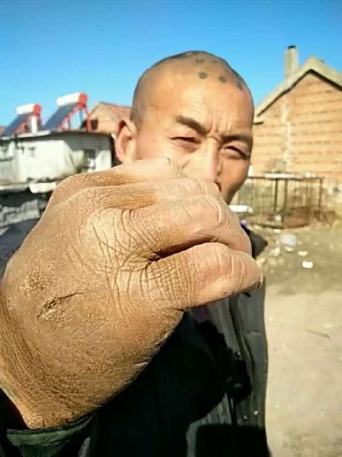 60岁大爷苦练"铁砂掌", 神功已练成, 却苦了这双手