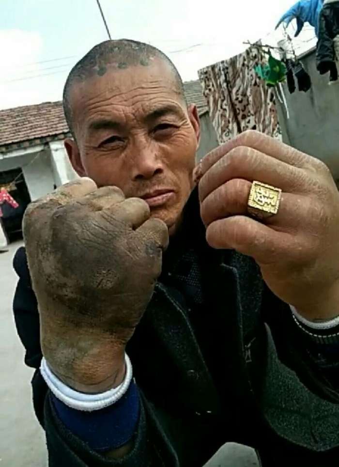 60岁大爷苦练"铁砂掌", 神功已练成, 却苦了这双手