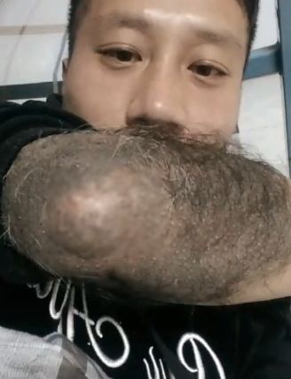 男子开直播给脸上画一只乌龟,网友发现他身上有一处异于常人!