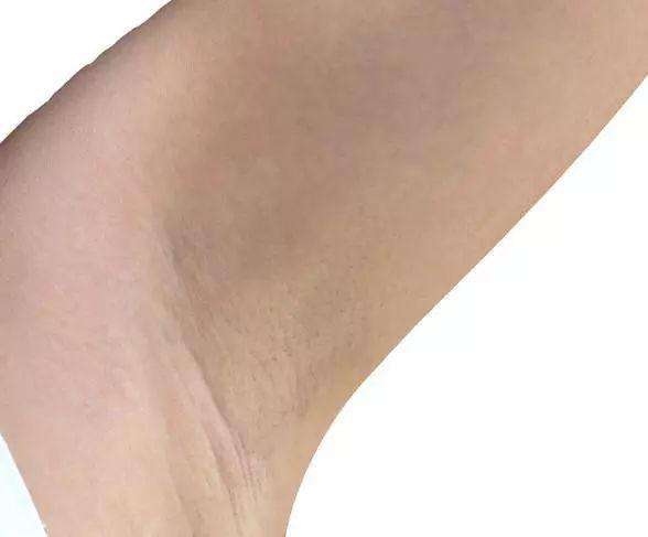 31岁女子作息规律查出乳腺癌1件事害了不少女性