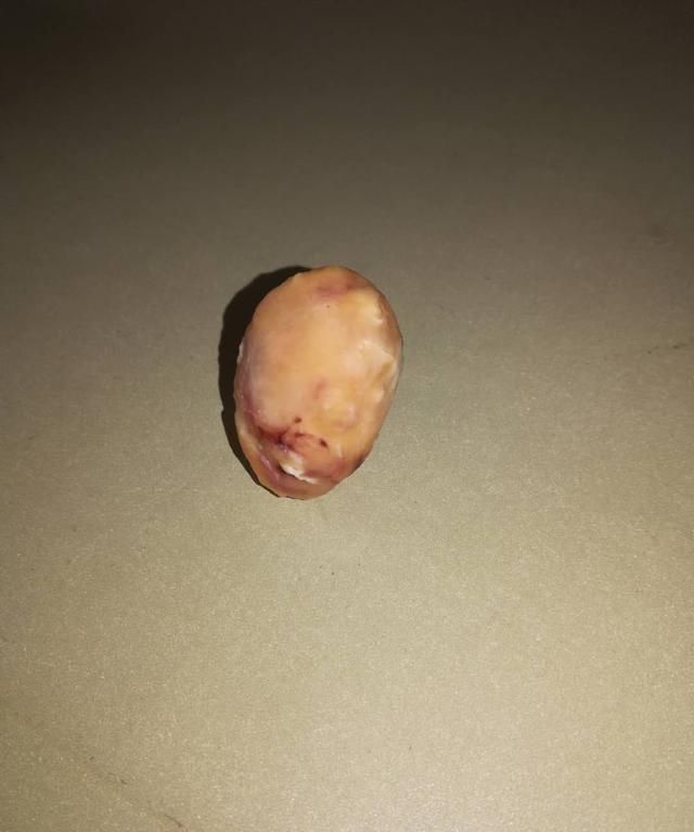 南充惊现鸭宝具有极高药用价值