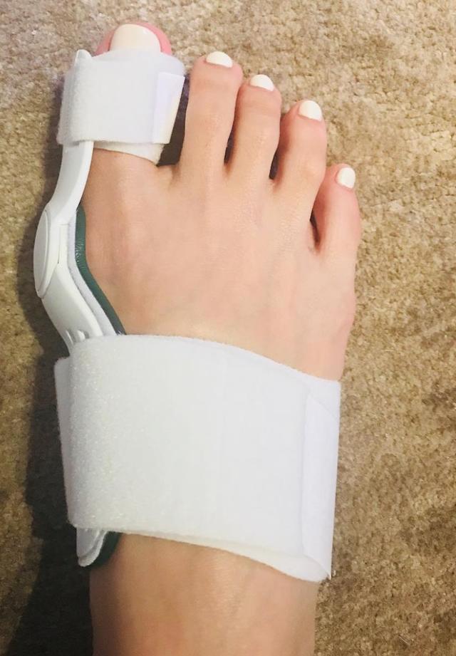 宋茜"脚趾外翻"好尴尬,恨天高这玩意儿还是悠着点穿吧