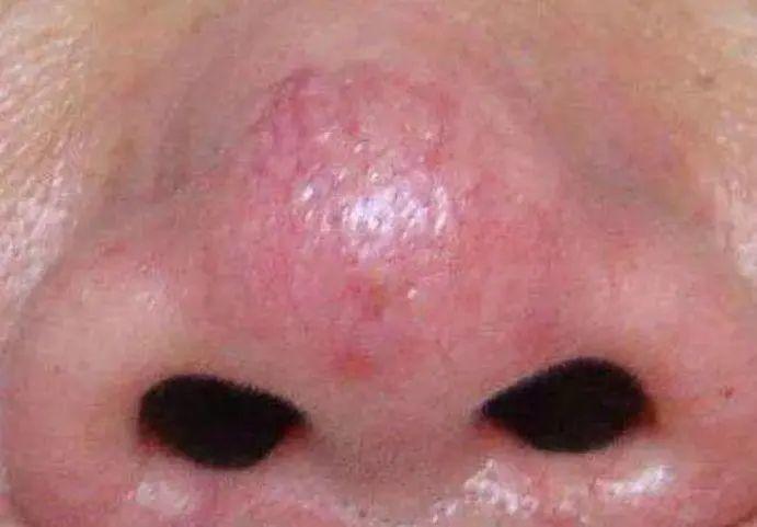 肺好不好从三个地方看不出养护肺部坚持做好五个一