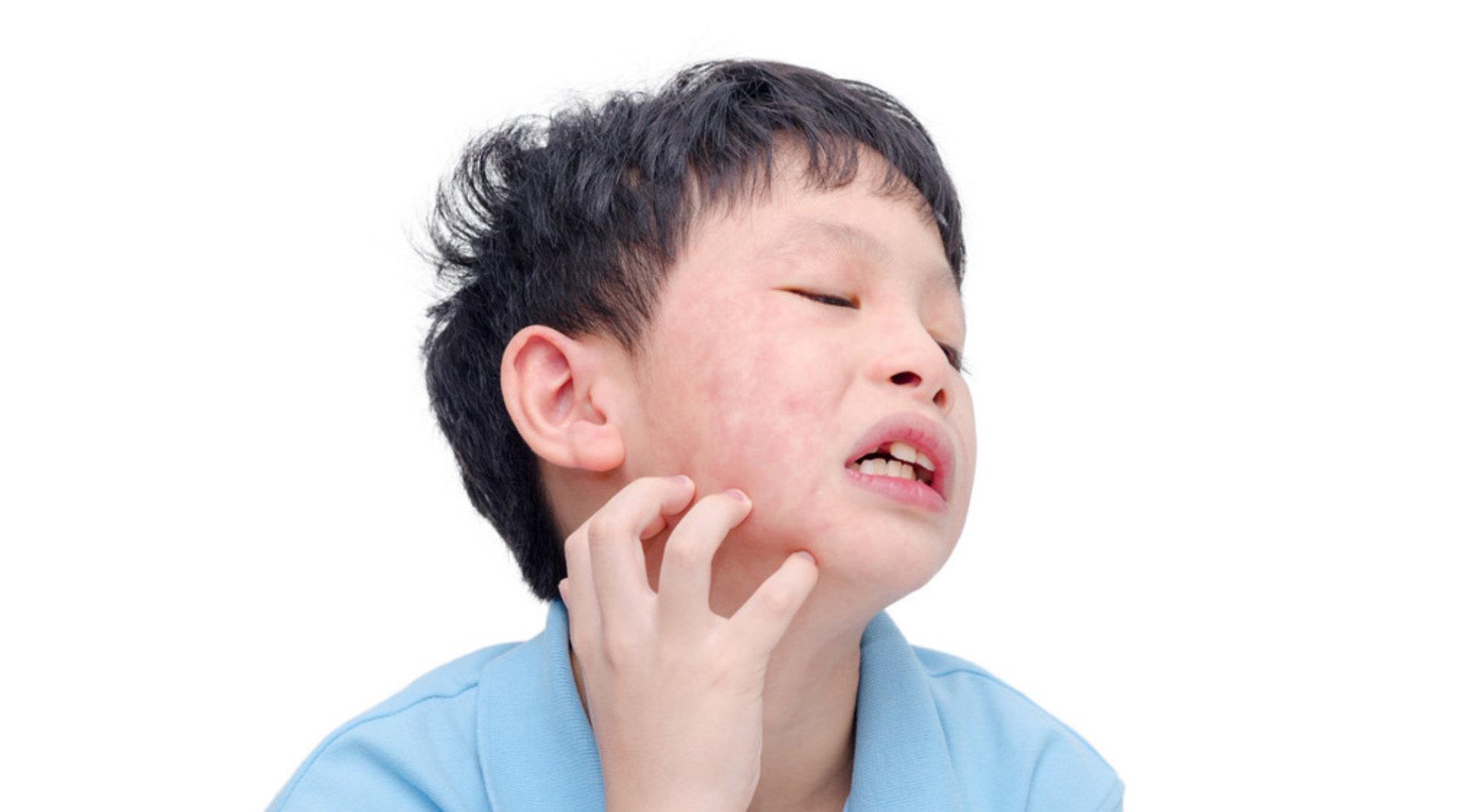 皮肤一过敏特别痒怎么办?如何快速止痒?医生教你3招_新浪新闻