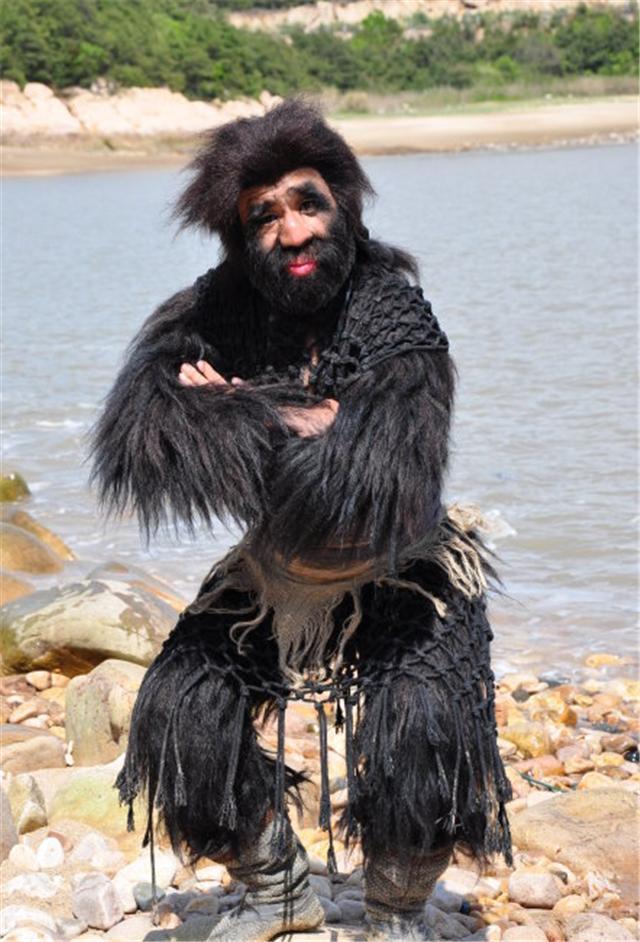 中国第一毛孩出生就被研究身体96覆盖黑毛42岁终遇真爱