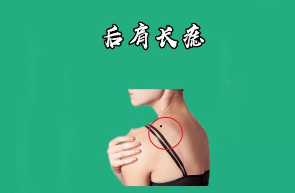 后肩长痣女人左肩后方有痣,通常代表田宅,同时也代表她们长辈缘分深厚