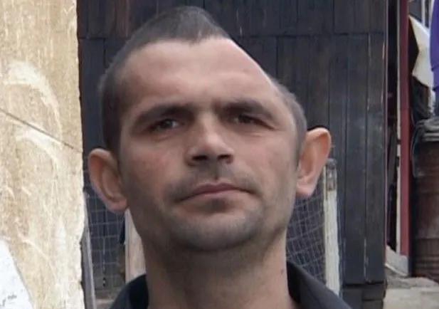 工人因工伤削掉小半个脑袋,保住了命却没钱做修复手术