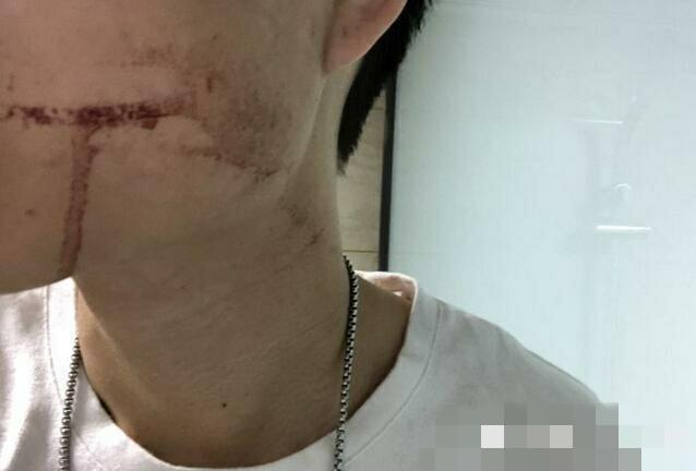 小伙拔牙15天后脑出血死亡曾半夜吐血到头晕医院隐身拒担责